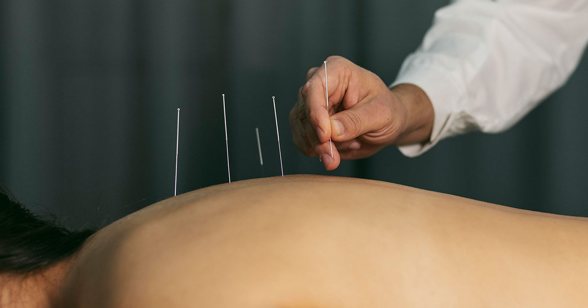 Få bukt med nakkesmerter ved hjelp av akupunktur behandling
