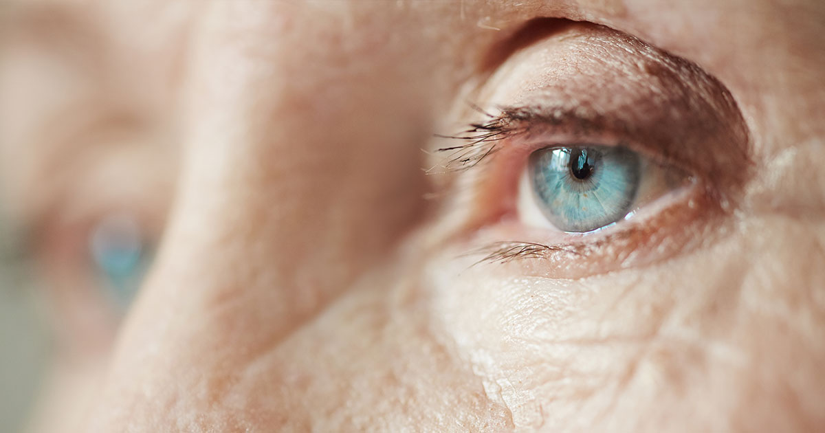 Grønn stær er en fellesbetegnelse på en gruppe øyesykdommer der synsnerven er svekket og fører til gradvis tap av synsfeltet. 