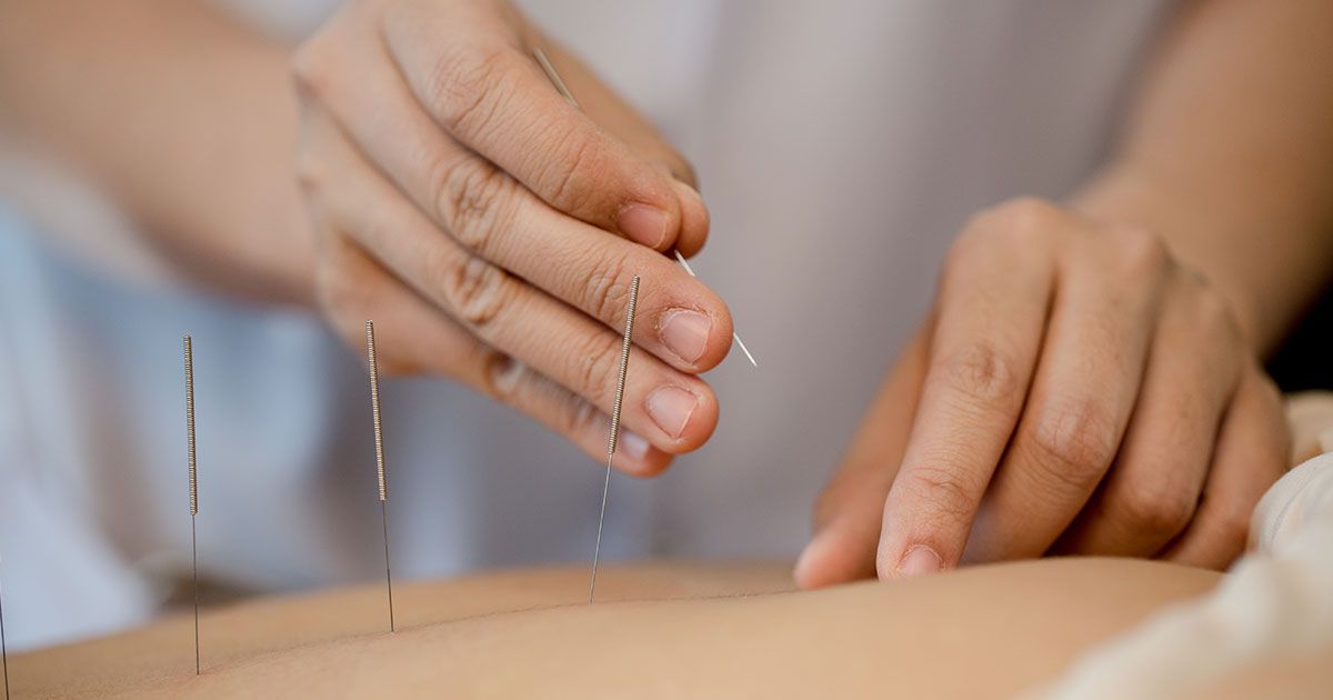 Hva er akupunktur?